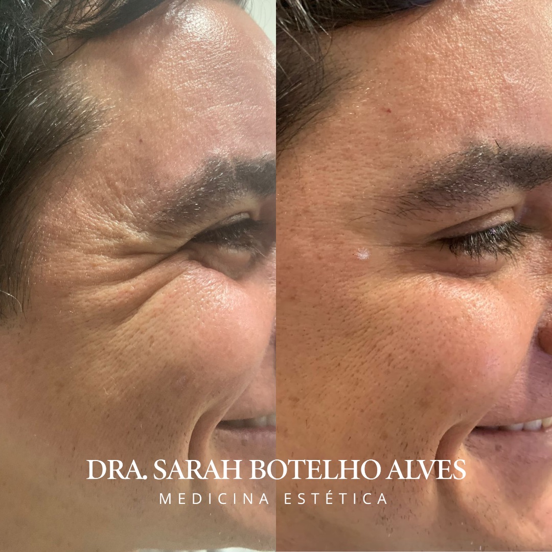 xr:d:DAEgEBHPHHo:9913,j:8075365400571254649,t:23120419