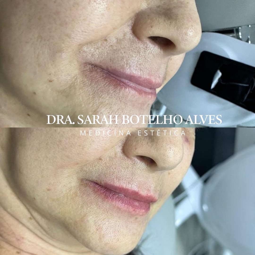 xr:d:DAEgEBHPHHo:9913,j:8075365400571254649,t:23120419