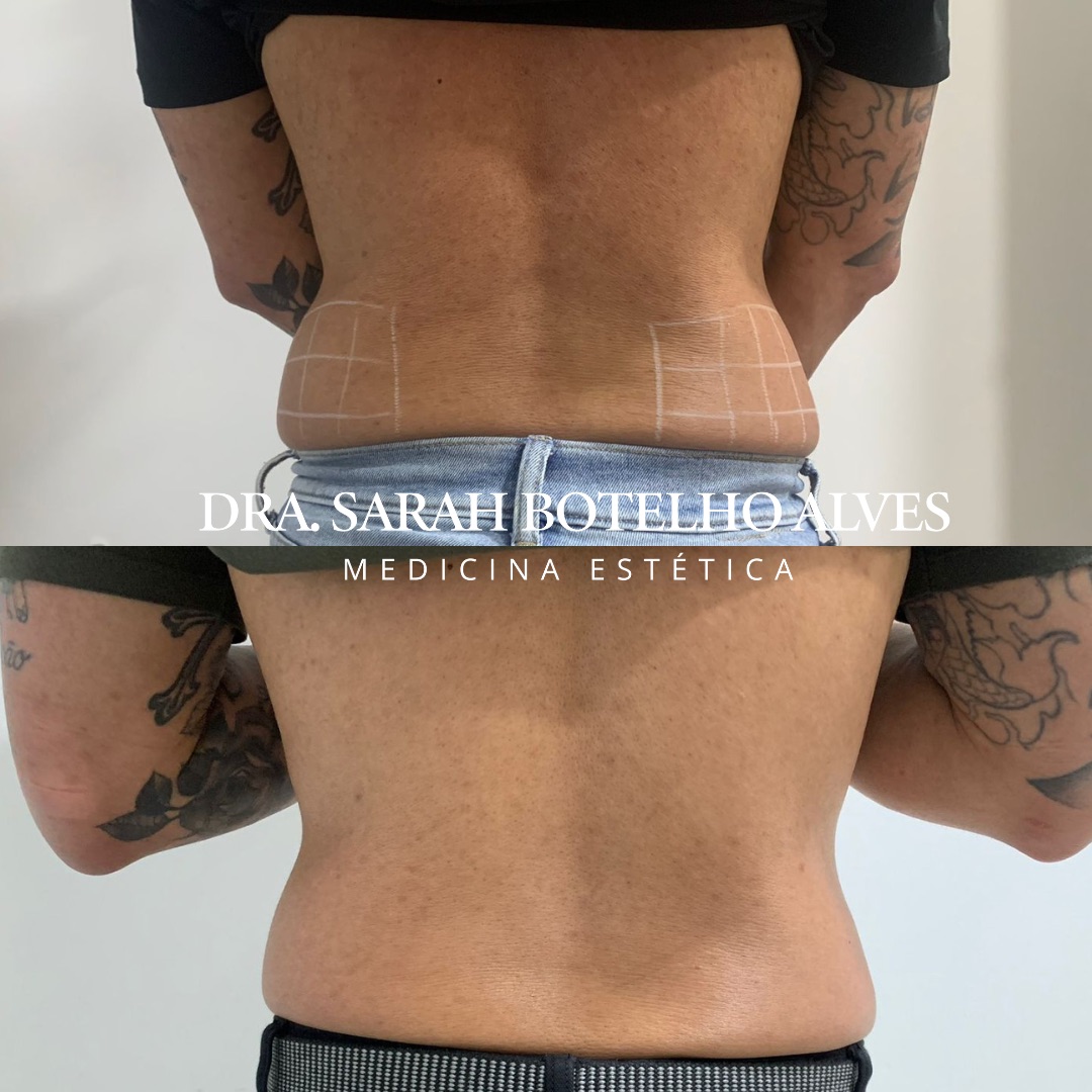 xr:d:DAEgEBHPHHo:9913,j:8075365400571254649,t:23120419