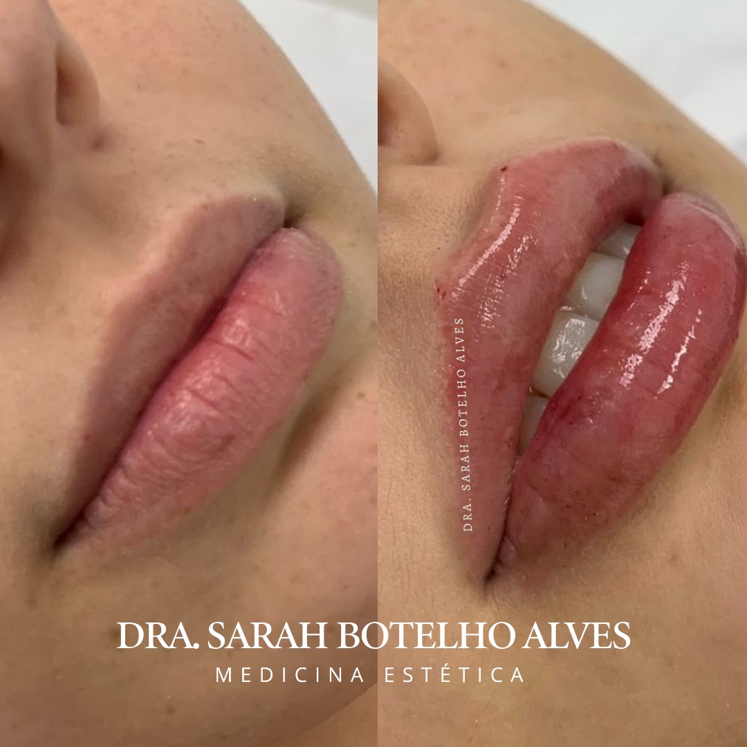 xr:d:DAEgEBHPHHo:9913,j:8075365400571254649,t:23120419