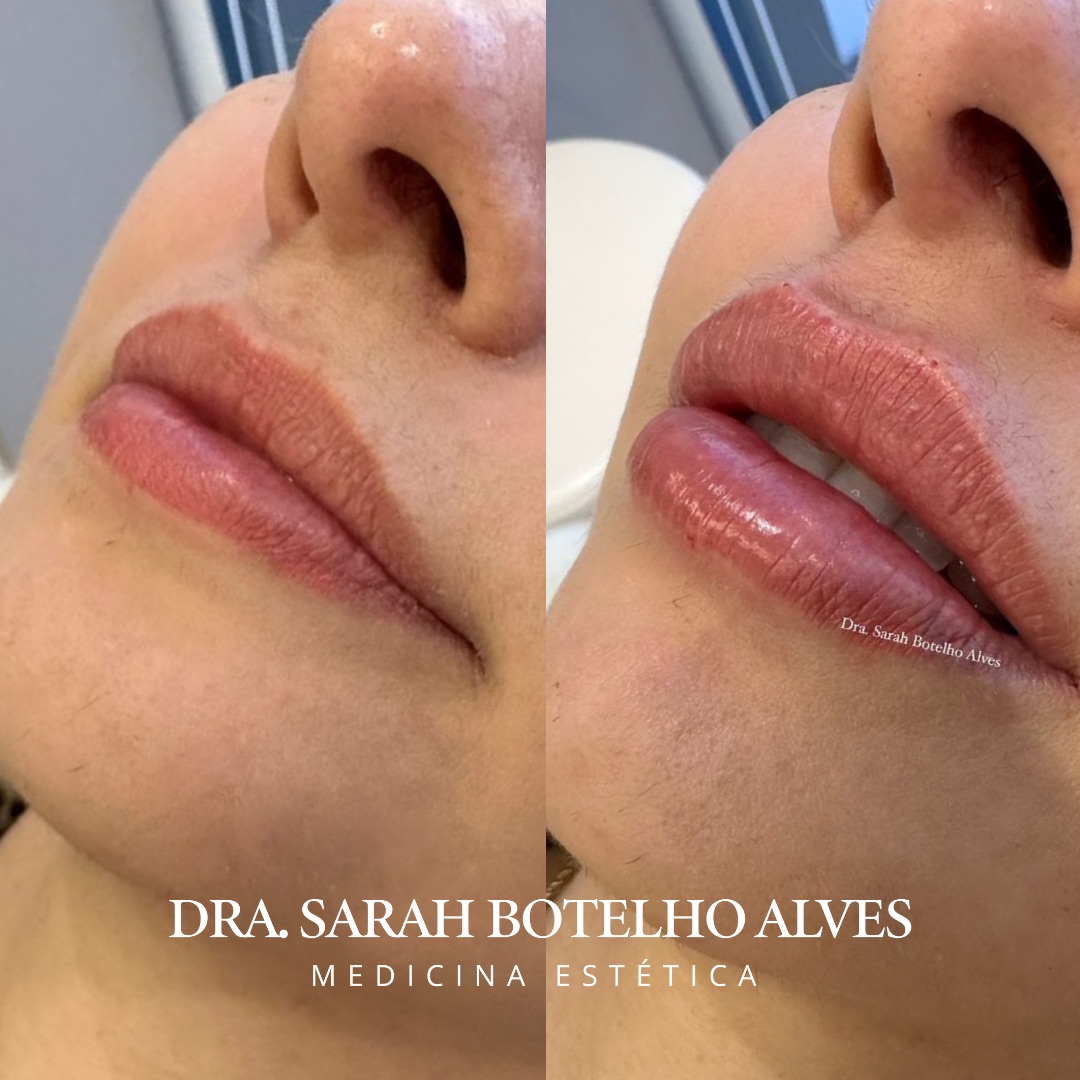 xr:d:DAEgEBHPHHo:9913,j:8075365400571254649,t:23120419