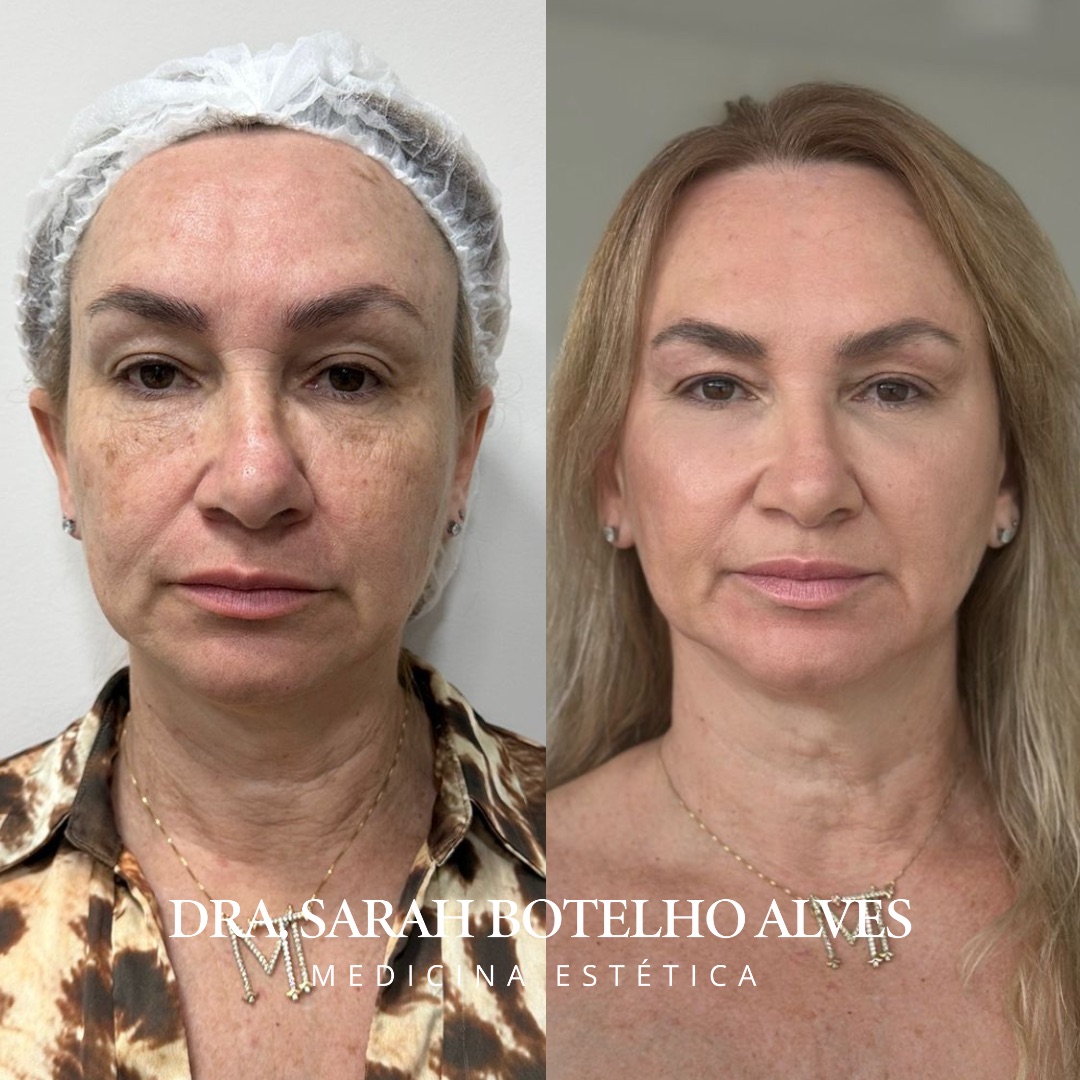 xr:d:DAEgEBHPHHo:9913,j:8075365400571254649,t:23120419