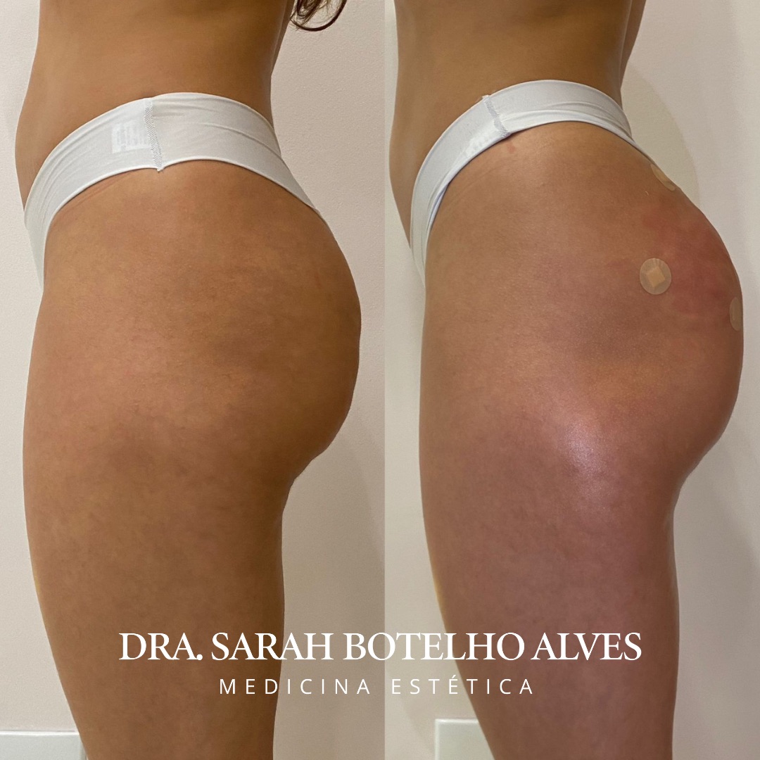 xr:d:DAEgEBHPHHo:9913,j:8075365400571254649,t:23120419