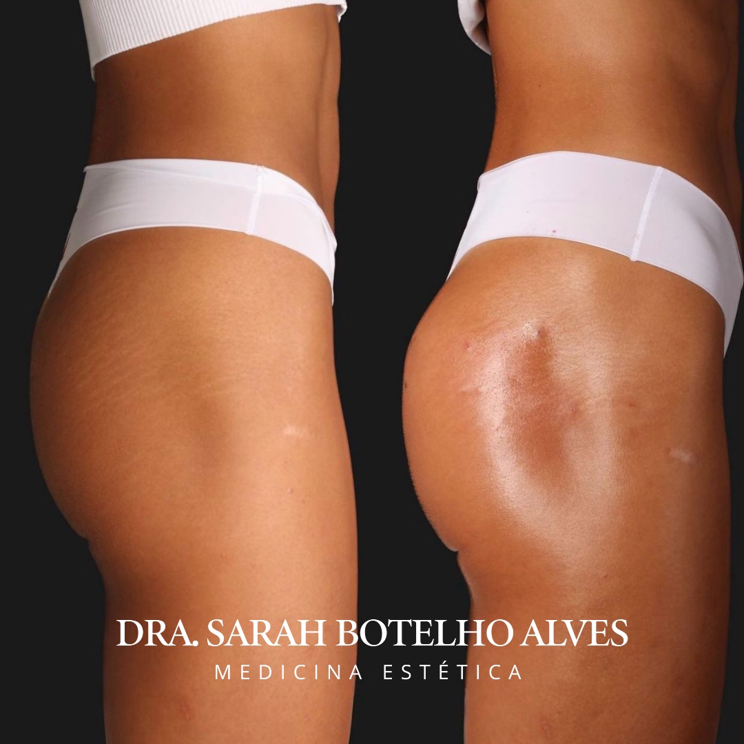 xr:d:DAEgEBHPHHo:9913,j:8075365400571254649,t:23120419