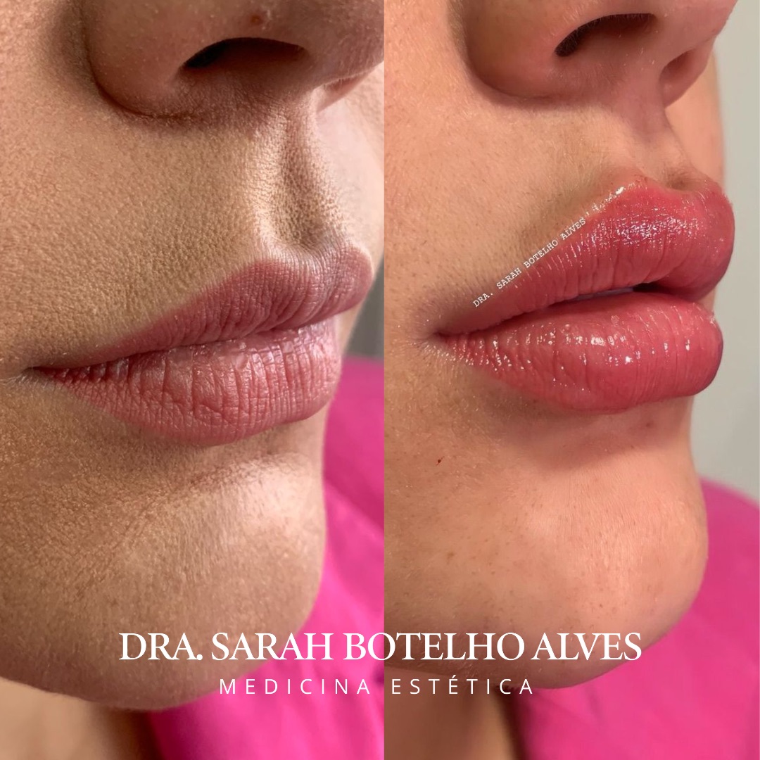 xr:d:DAEgEBHPHHo:9913,j:8075365400571254649,t:23120419