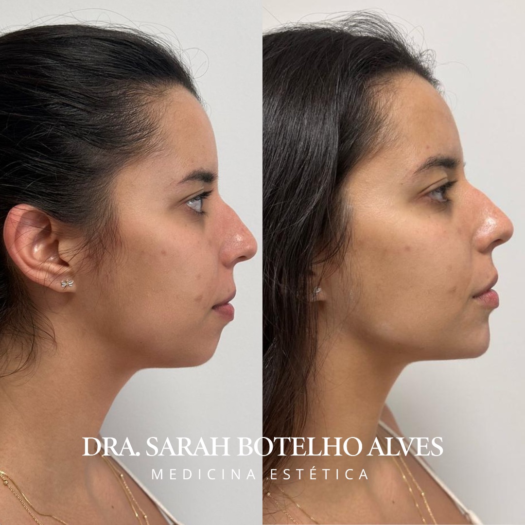 xr:d:DAEgEBHPHHo:9918,j:7134113076417230863,t:23120419