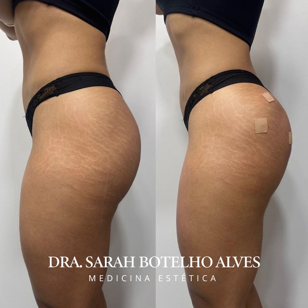 xr:d:DAEgEBHPHHo:9913,j:8075365400571254649,t:23120419